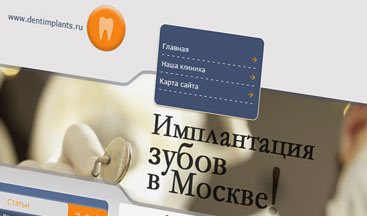 TEETH IMPLANTATION IN MOSCOW - Website Design and Development